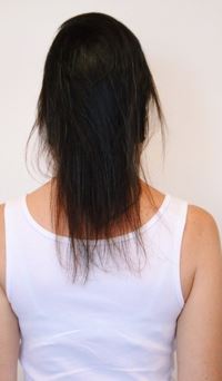 Antes