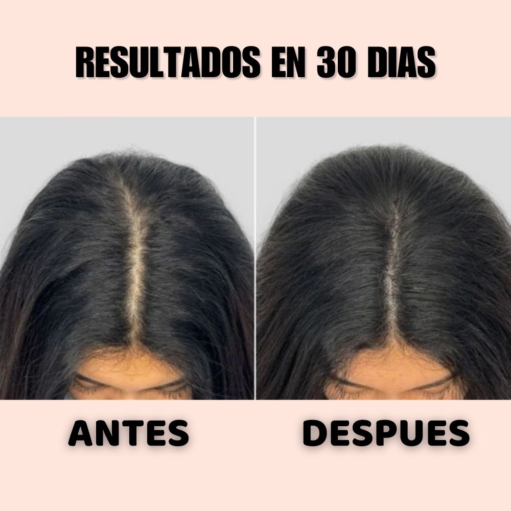 TONICO ANTERA 👉 RECUPERA TU CABELLO EN 30 DIAS O TE DEVOLVEMOS TU DINERO